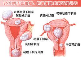 卵巢囊肿的表现有哪些