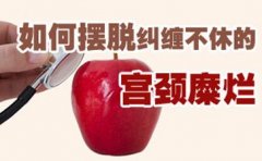 女性宫颈糜烂的原因有什么
