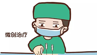 杭州做下面缩小术需要多少钱